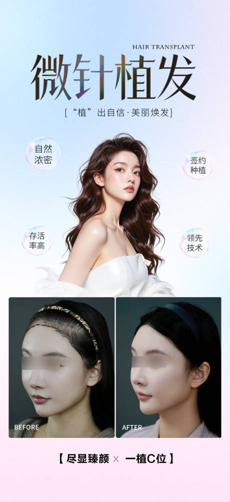 源文件下載【享設計】搜索編號：77600033025611214【微針植發案例宣傳海報】
