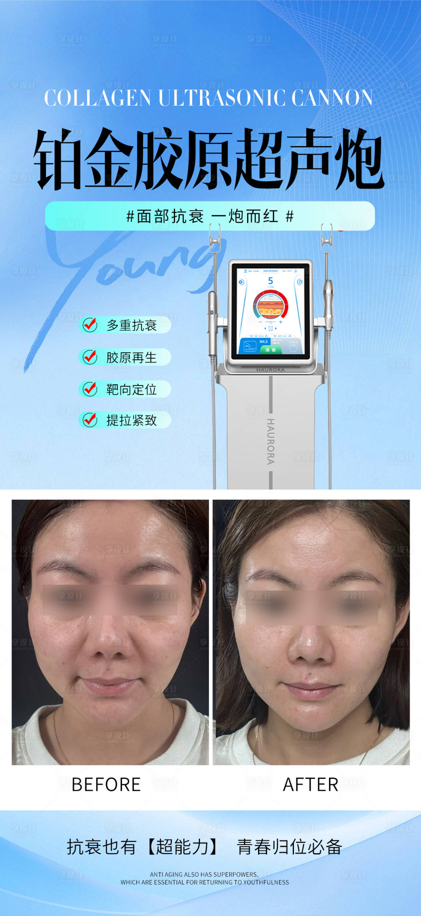 源文件下載【享設(shè)計(jì)】搜索編號(hào)：39620032958787894【膠原超聲炮案例】