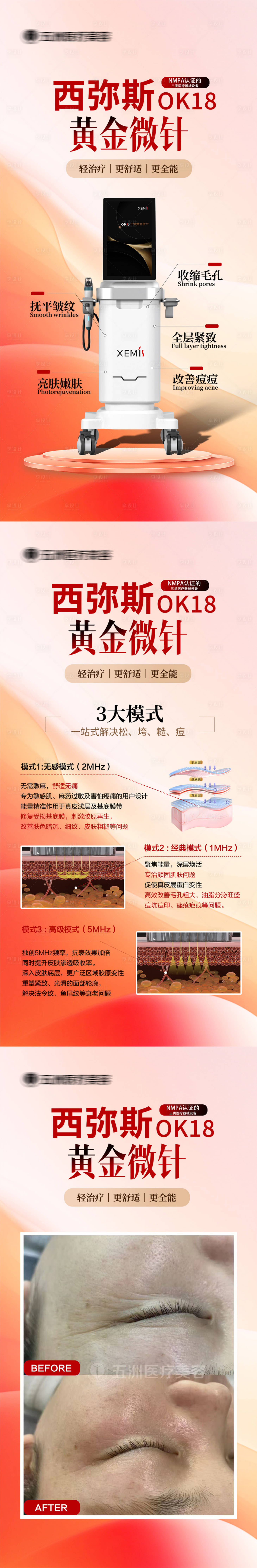 源文件下载【享设计】搜索编号：23180033308404840【无痛黄金微针案例】