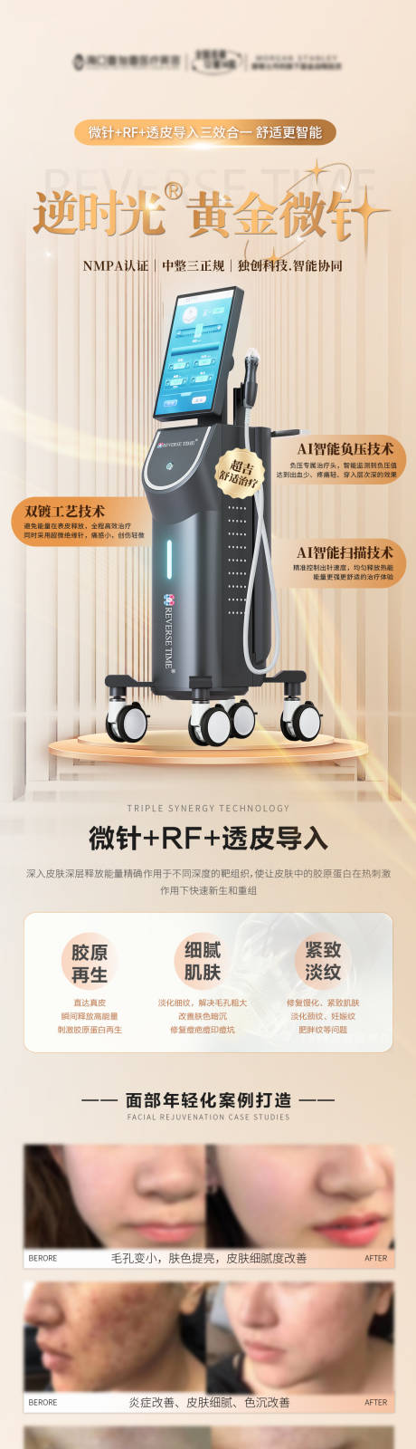 源文件下載【享設計】搜索編號：62370033094407445【逆時光黃金微針醫美科普海報】
