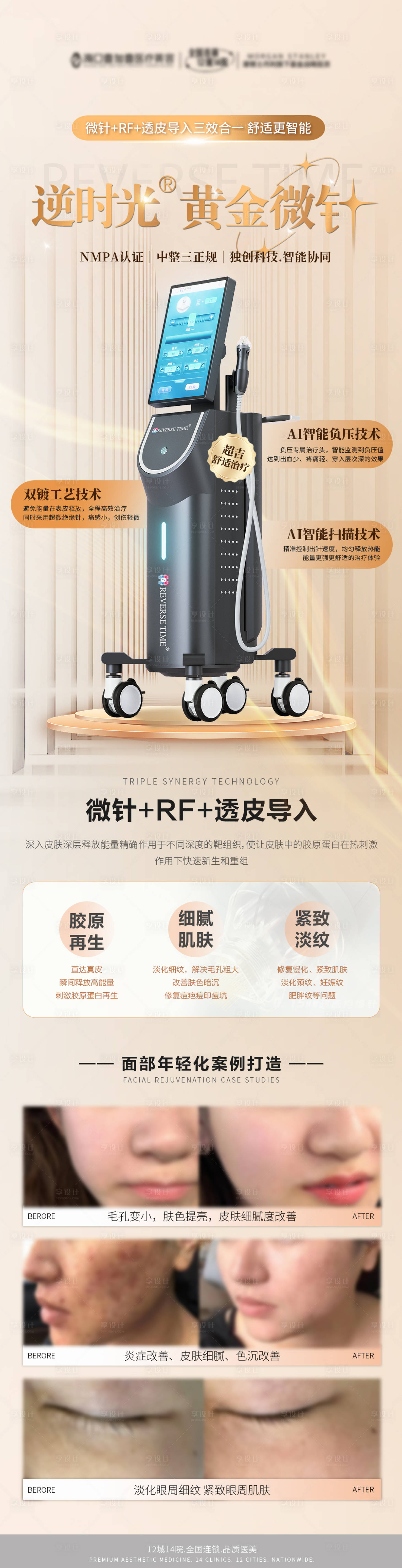 源文件下載【享設計】搜索編號：62370033094407445【逆時光黃金微針醫美科普海報】