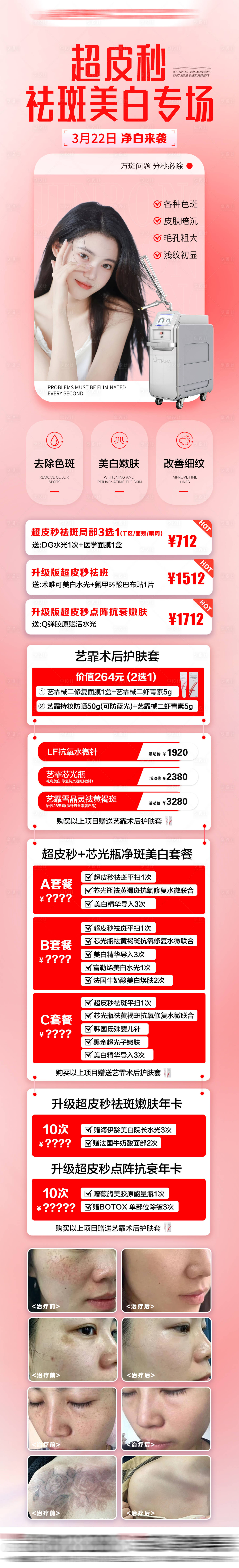 源文件下載【享設計】搜索編號：58340032984535230【超皮秒祛斑長圖】