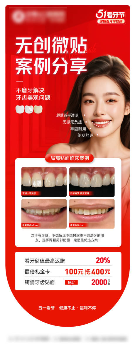 源文件下載【享設計】搜索編號：64700033152734653【美白瓷貼面案例宣傳海報】