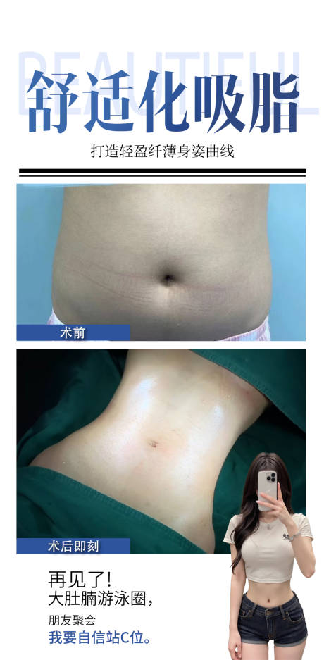 源文件下載【享設(shè)計】搜索編號：23970032959014679【舒適化吸脂案例】