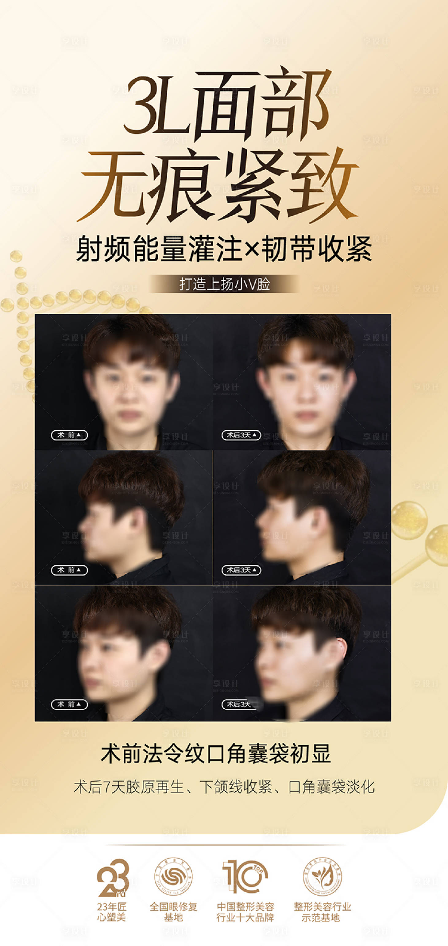 源文件下载【享设计】搜索编号：64350033326109299【医美海报  】