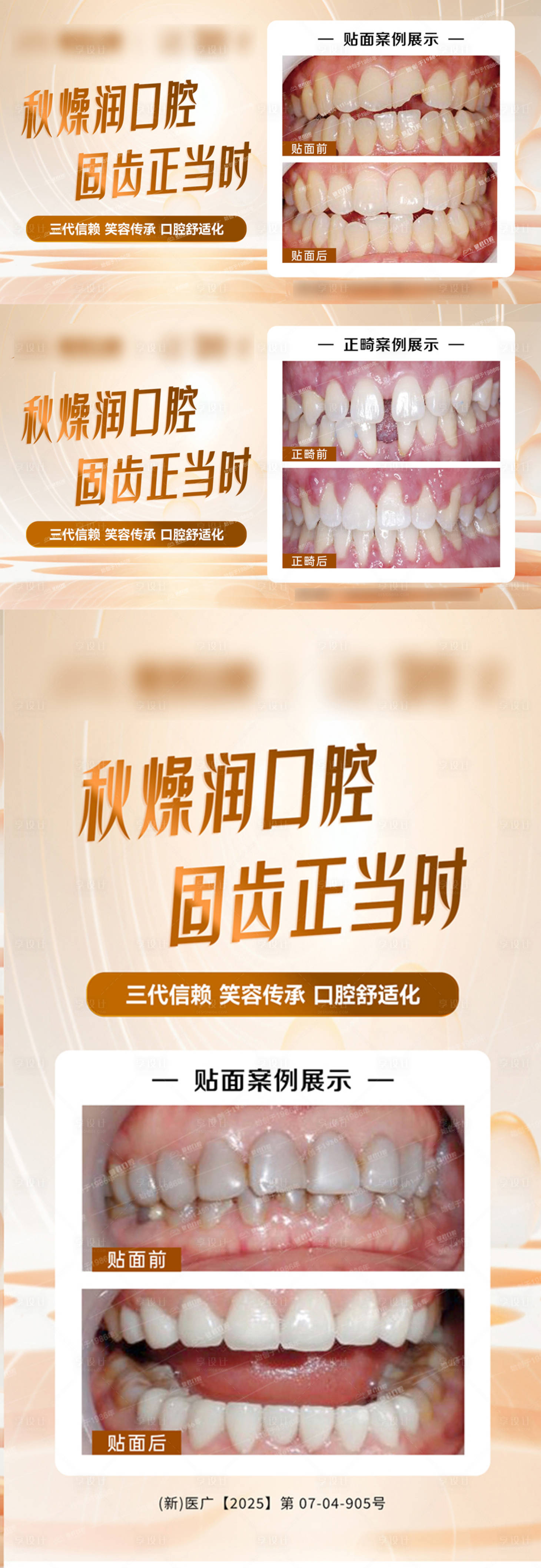源文件下载【享设计】搜索编号：23490032863126155【口腔秋季案例海报对比】