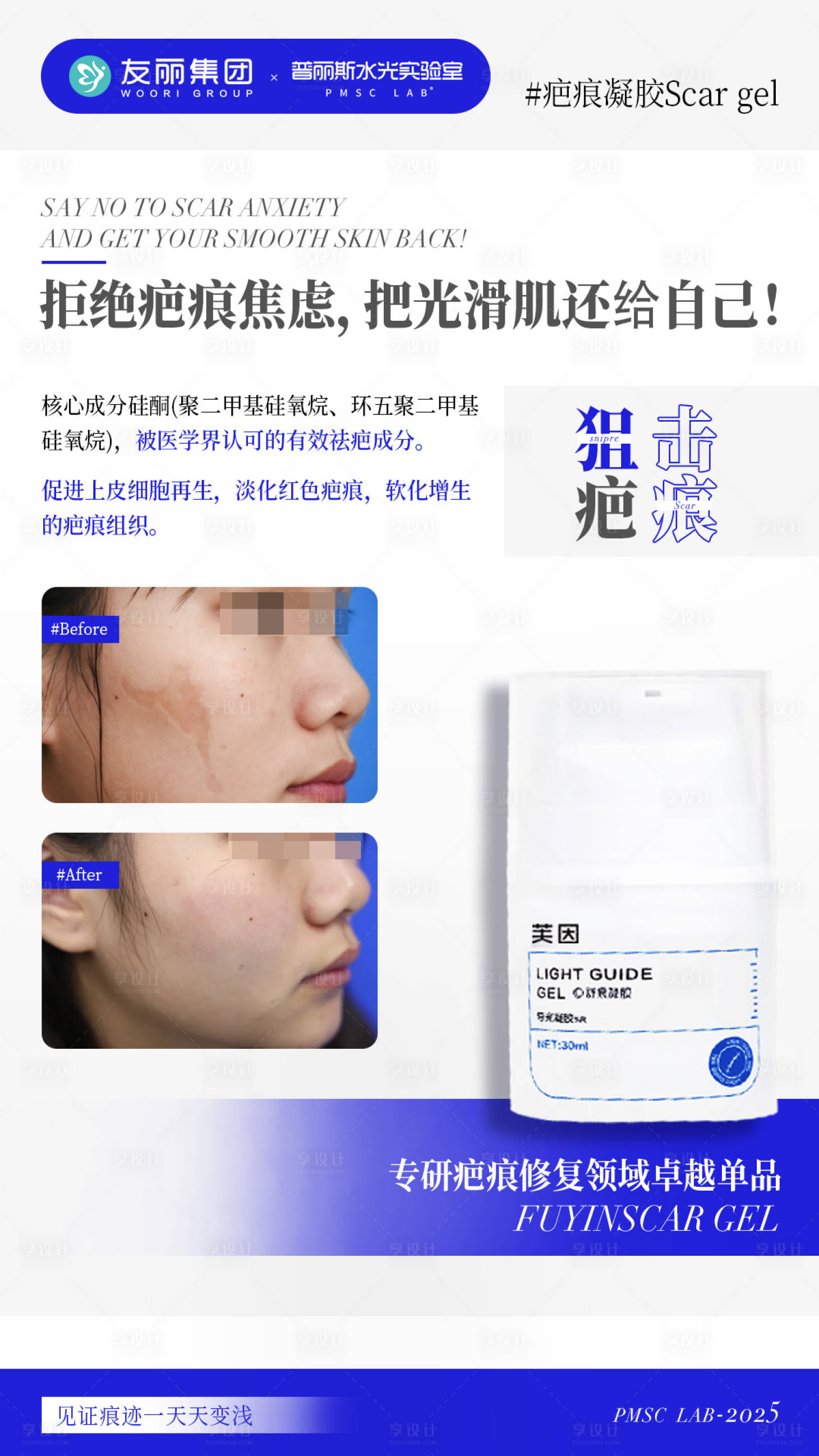 源文件下载【享设计】搜索编号：36390032938955962【拒绝疤痕焦虑】