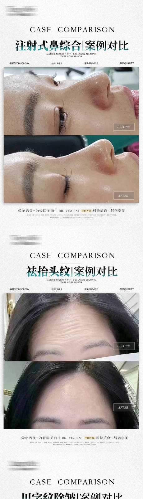 源文件下載【享設(shè)計(jì)】搜索編號(hào)：91310032912682043【醫(yī)美簡(jiǎn)約案例】