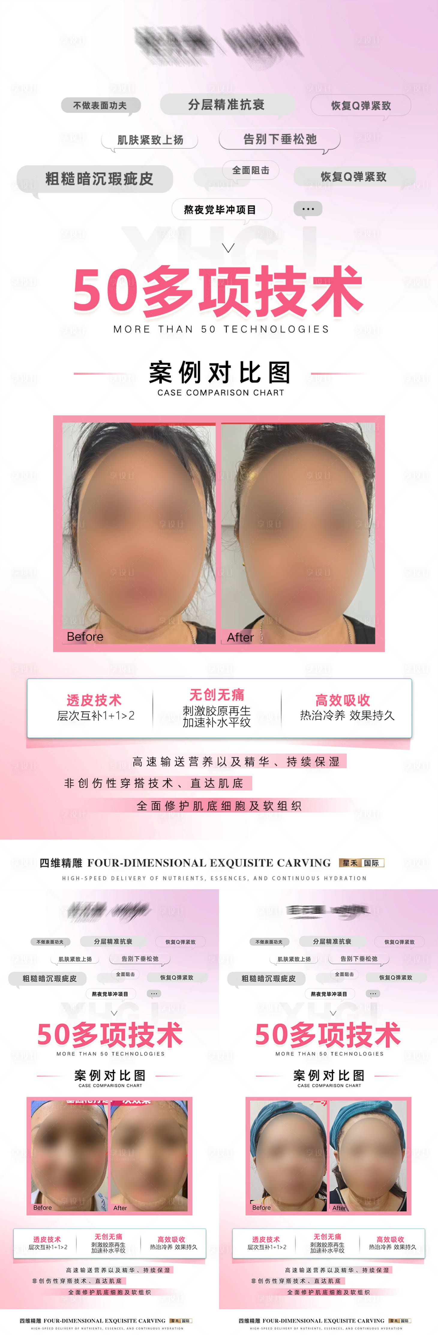 源文件下载【享设计】搜索编号：86940032948204610【医美脸部抗衰宣传海报】