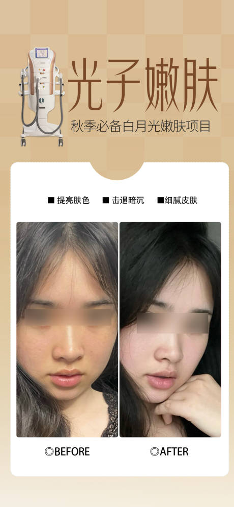 源文件下載【享設計】搜索編號：85830033025415033【光子嫩膚案例】
