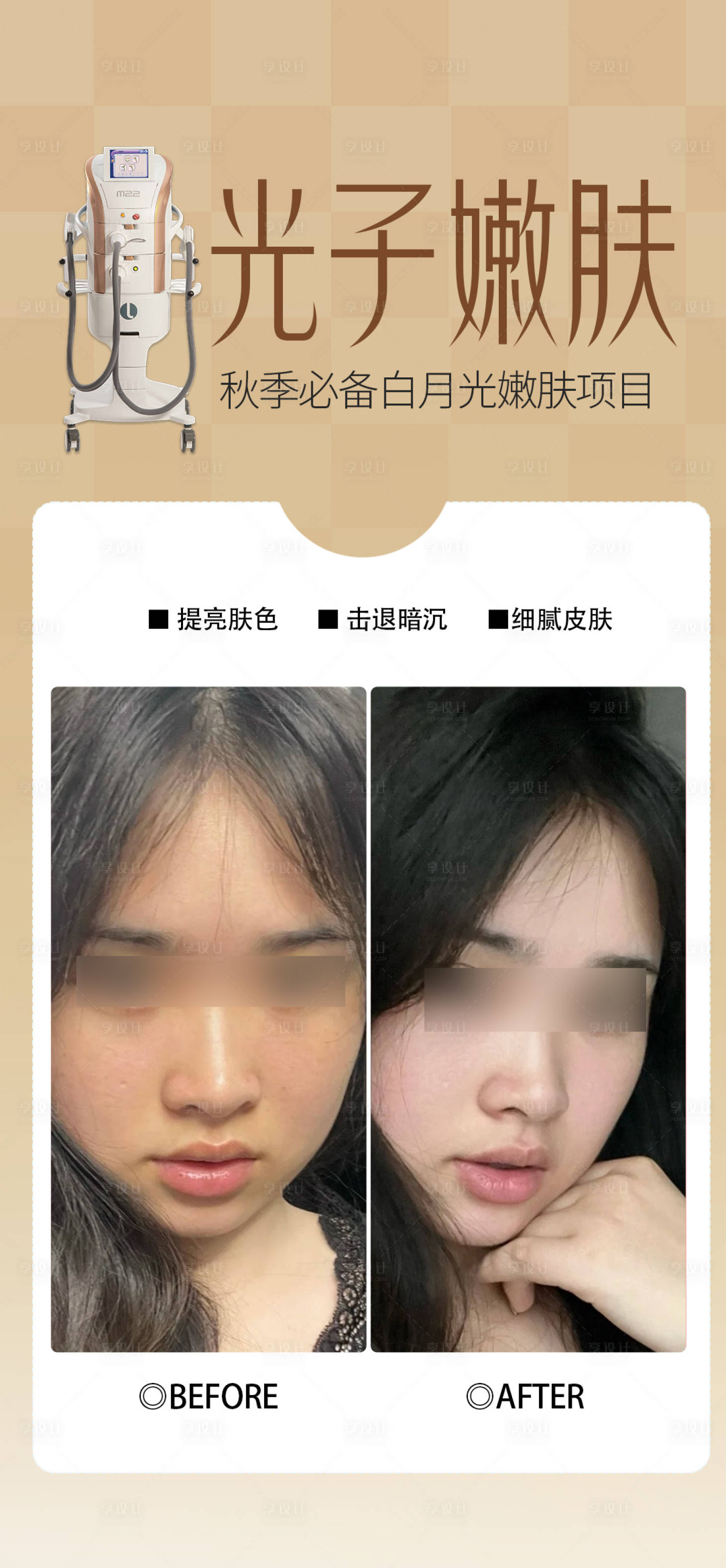 源文件下載【享設計】搜索編號：85830033025415033【光子嫩膚案例】