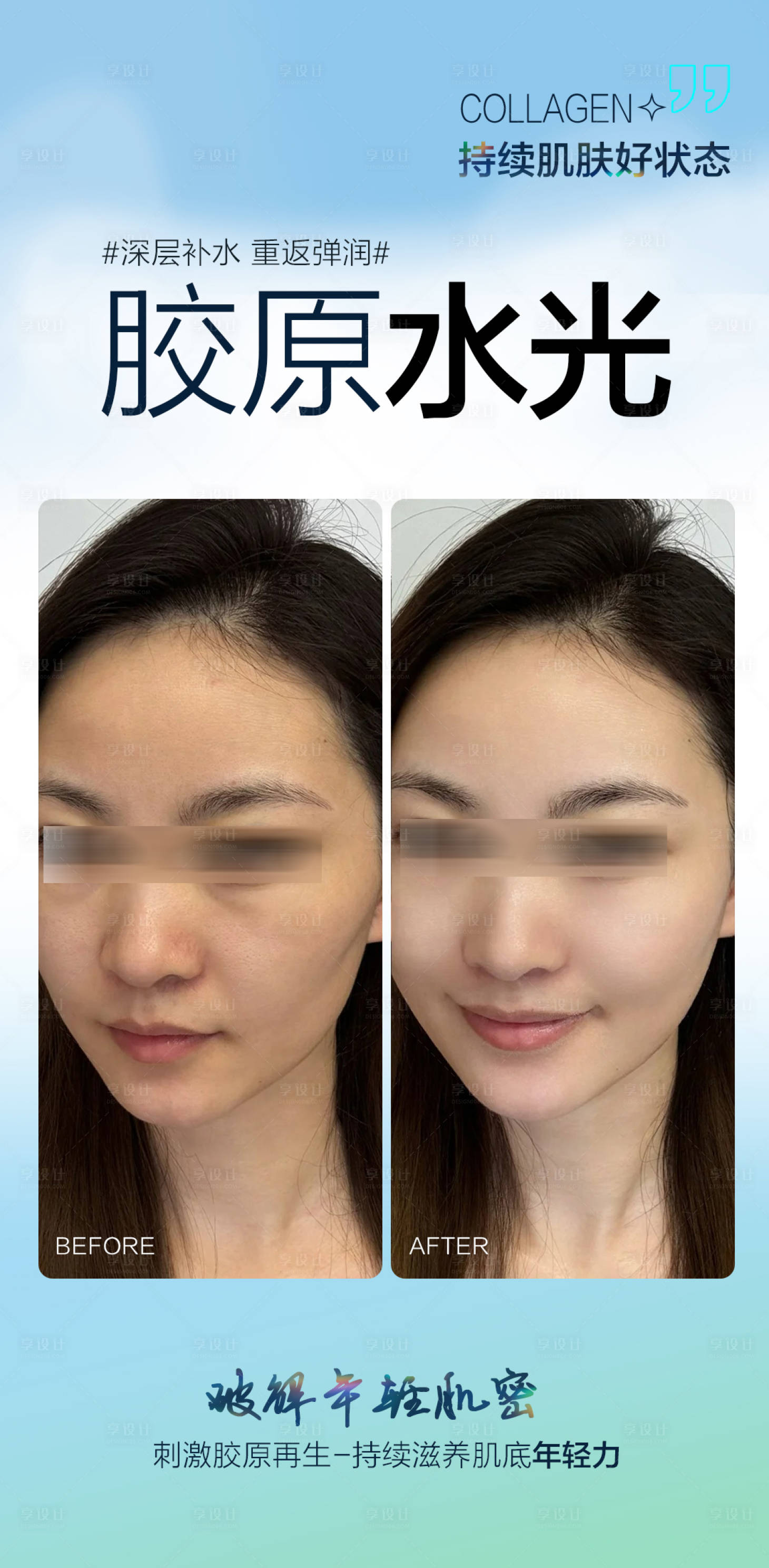源文件下载【享设计】搜索编号：79260032893329829【胶原水光案例海报】