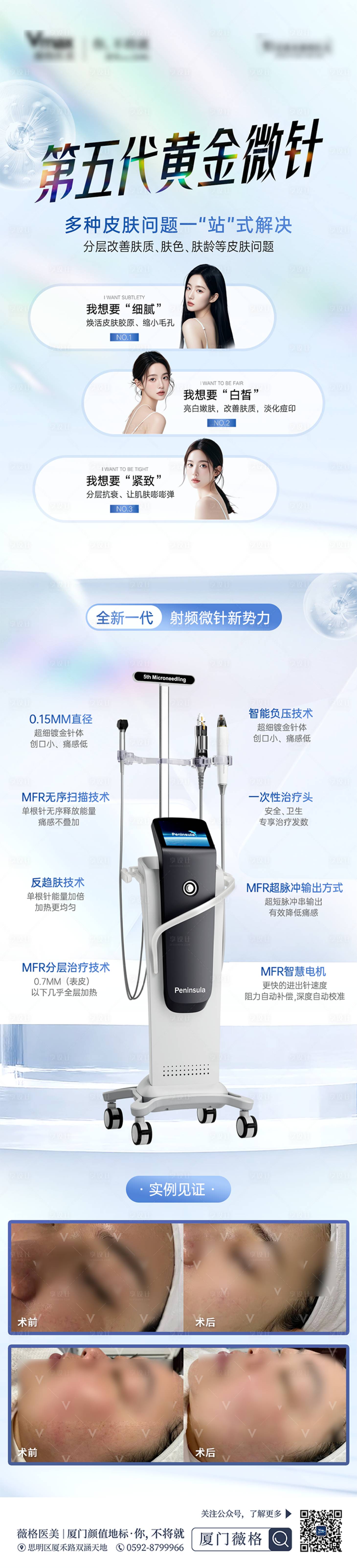 源文件下载【享设计】搜索编号：90000032845306011【医美第五代黄金微针宣传科普案例对比】