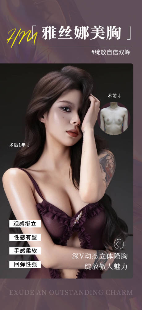 源文件下载【享设计】搜索编号：96380033354928493【雅丝娜美胸案例】