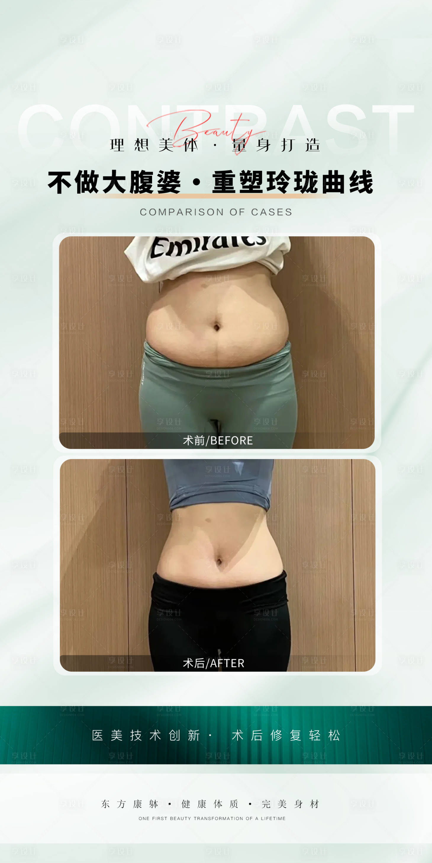 源文件下载【享设计】搜索编号：90490033286913735【案例对比图体抗衰减肥身材案例】