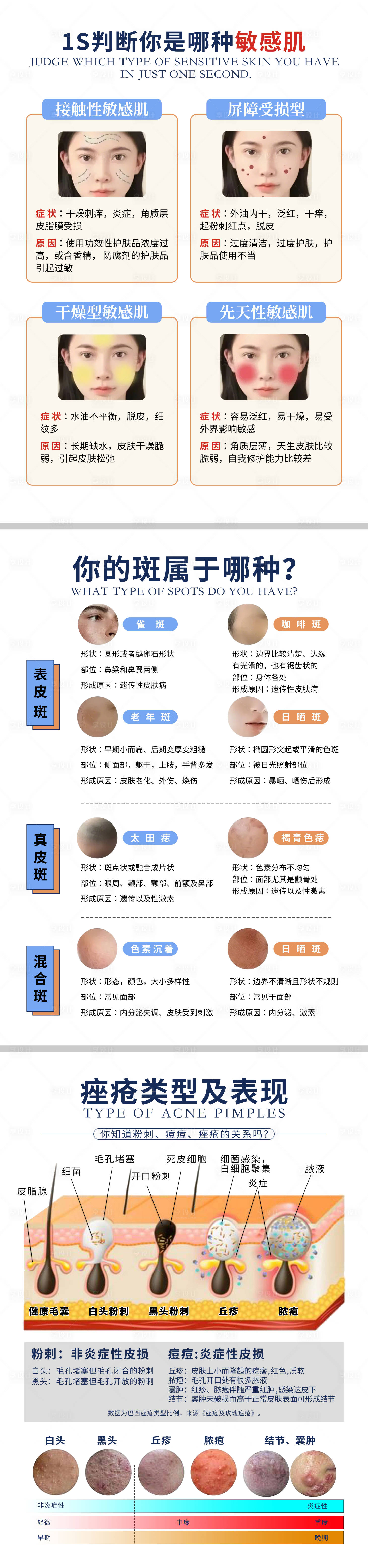 源文件下载【享设计】搜索编号：50510032899298290【医美皮肤痤疮类型长图海报】