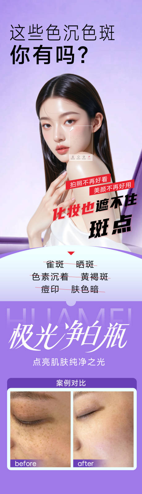 源文件下載【享設計】搜索編號：38650033067791632【祛斑海報】