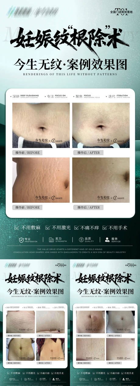 源文件下載【享設計】搜索編號：10600033012162256【妊娠紋對比案例】