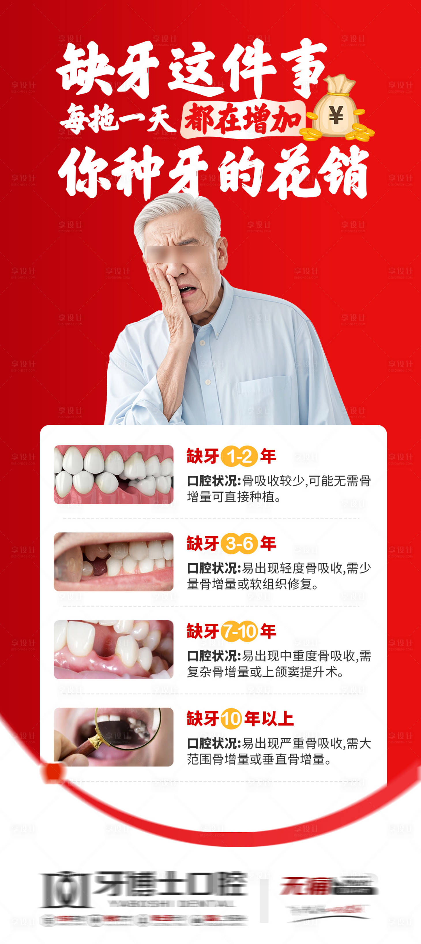源文件下載【享設(shè)計】搜索編號：79080033116552477【種植牙海報】