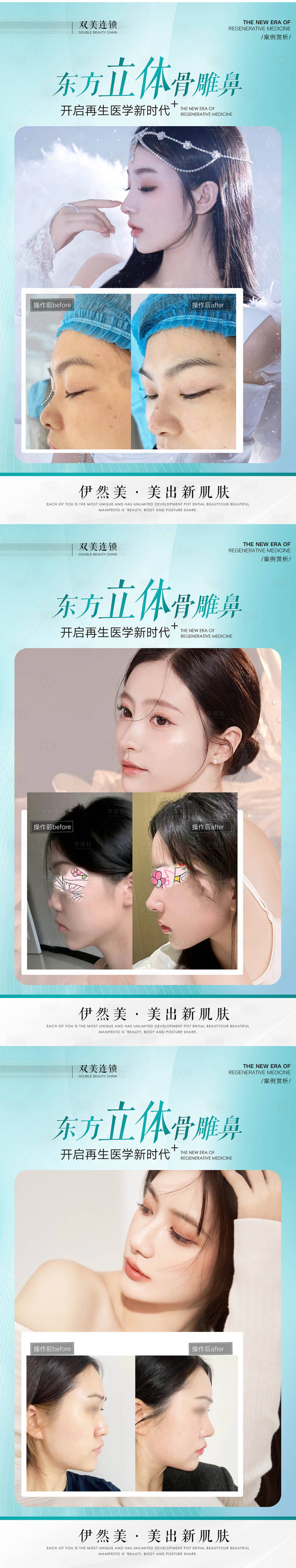 源文件下载【享设计】搜索编号：12450033180009486【鼻子案例】