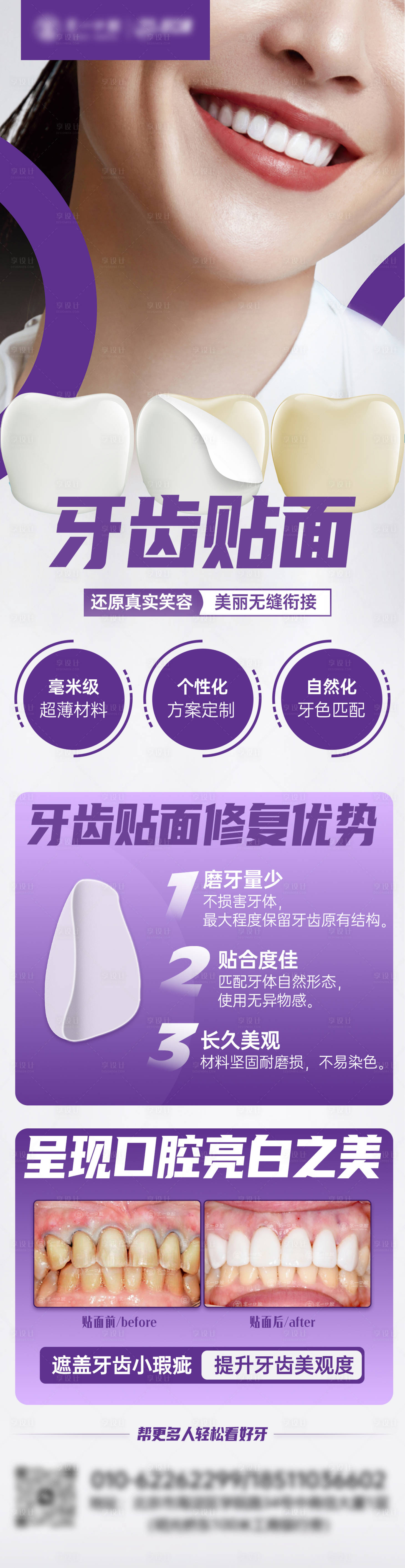 源文件下载【享设计】搜索编号：46330033331332014【牙齿贴面海报】