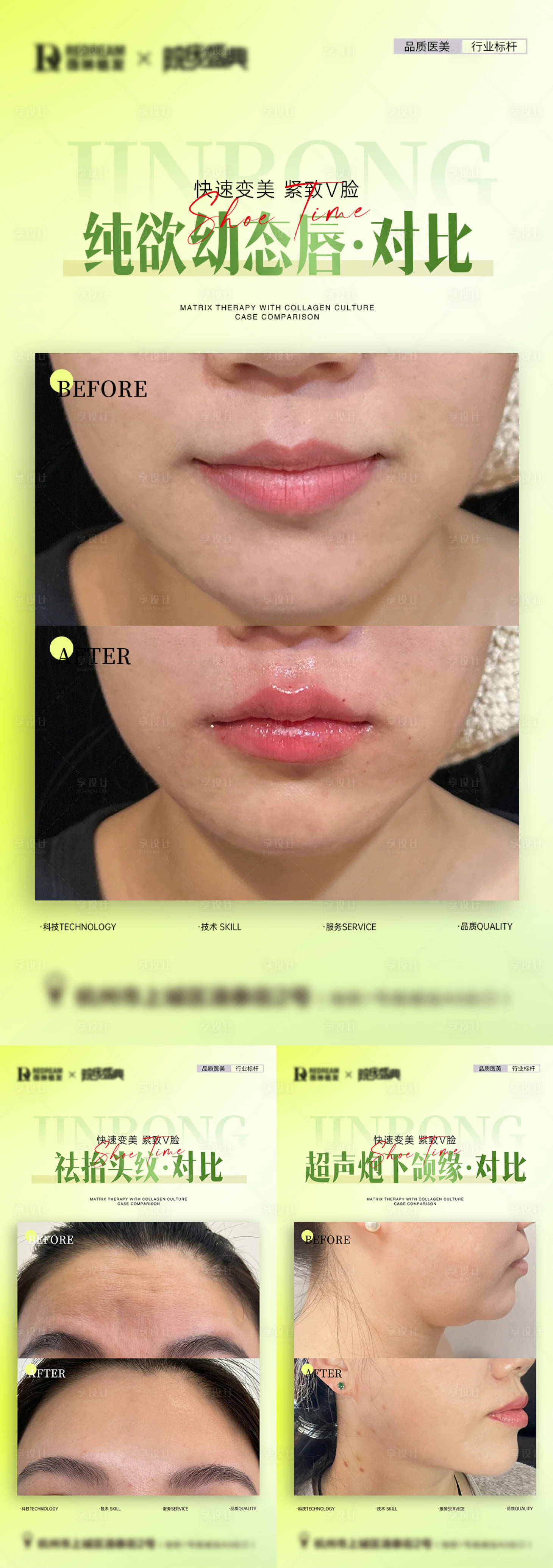 源文件下载【享设计】搜索编号：30500033287655599【医美春天案例对比】