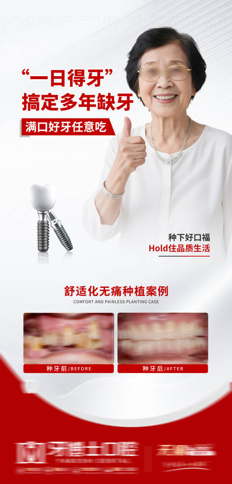 源文件下載【享設(shè)計(jì)】搜索編號(hào)：35070032977455820【種植牙海報(bào)】
