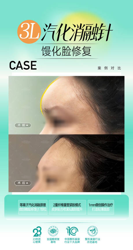 源文件下載【享設(shè)計(jì)】搜索編號(hào)：45330033102594604【整形美容海報(bào)  】