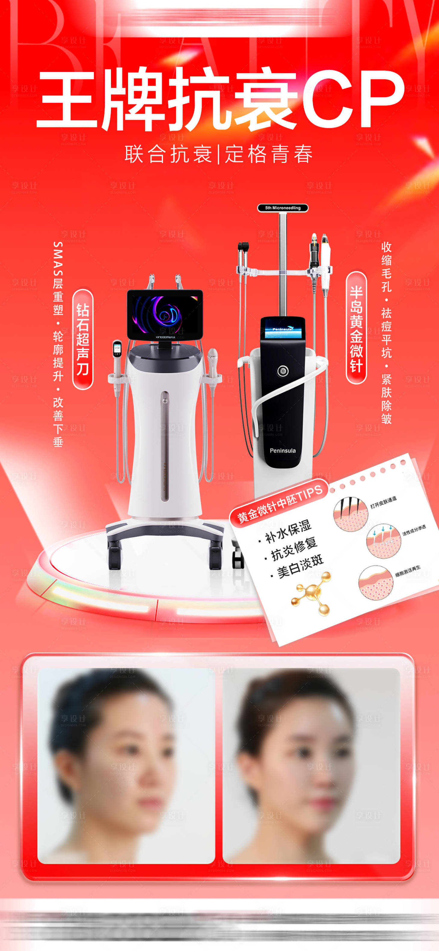 源文件下載【享設計】搜索編號：54540033053132850【超聲刀抗衰案例對比海報】