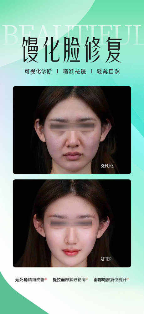 源文件下载【享设计】搜索编号：47580032845427430【馒化脸修复案例】