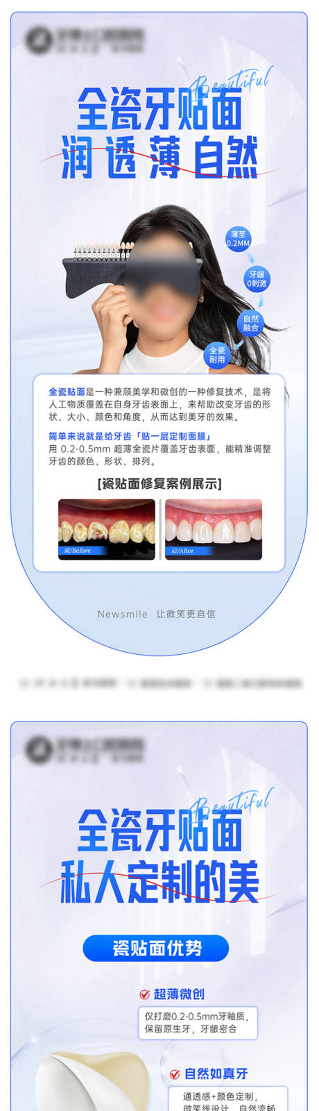 源文件下载【享设计】搜索编号：82640032860363776【口腔瓷贴面美白海报】