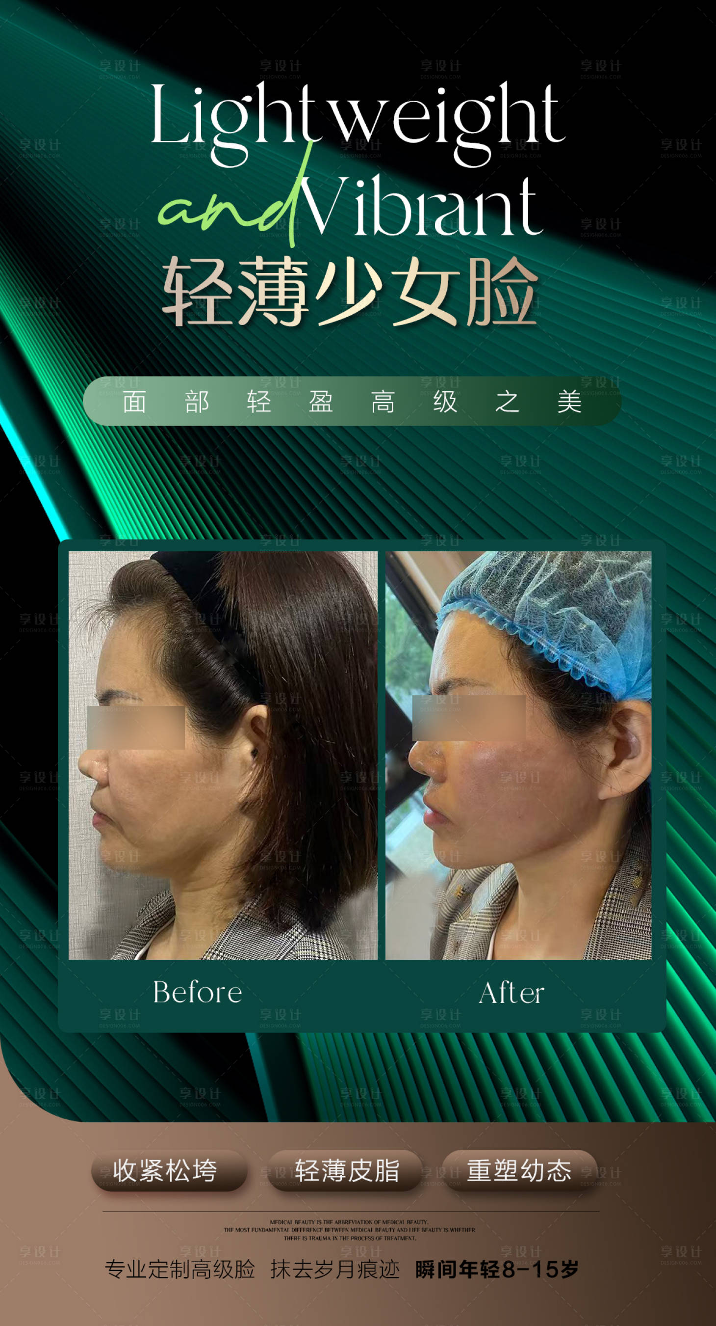 源文件下载【享设计】搜索编号：16380033340992769【医美对比图】
