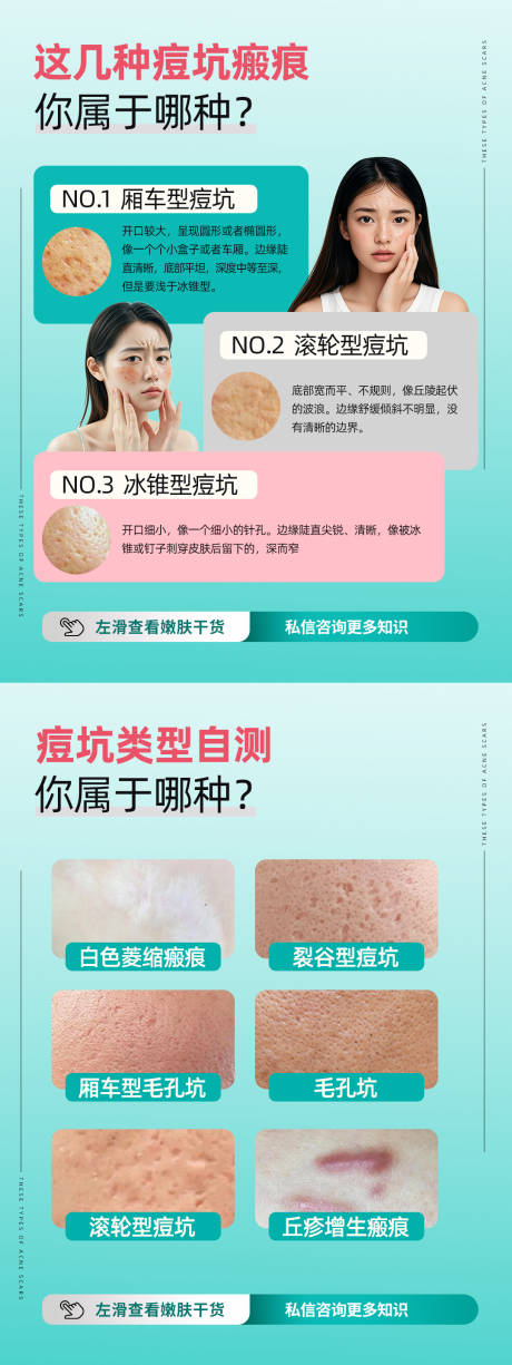 源文件下载【享设计】搜索编号：13870033245697844【这几种痘坑瘢痕】