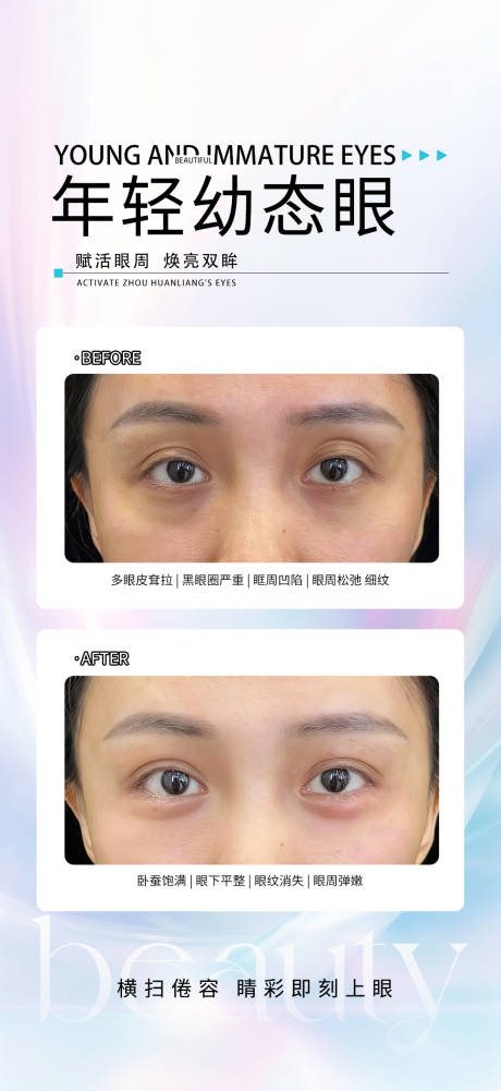 源文件下载【享设计】搜索编号：41920033644409657【幼态眼】