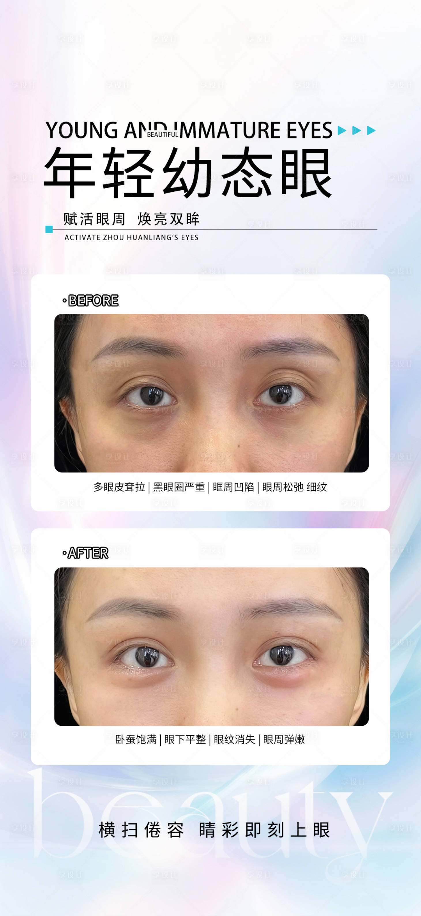 源文件下载【享设计】搜索编号：41920033644409657【幼态眼】