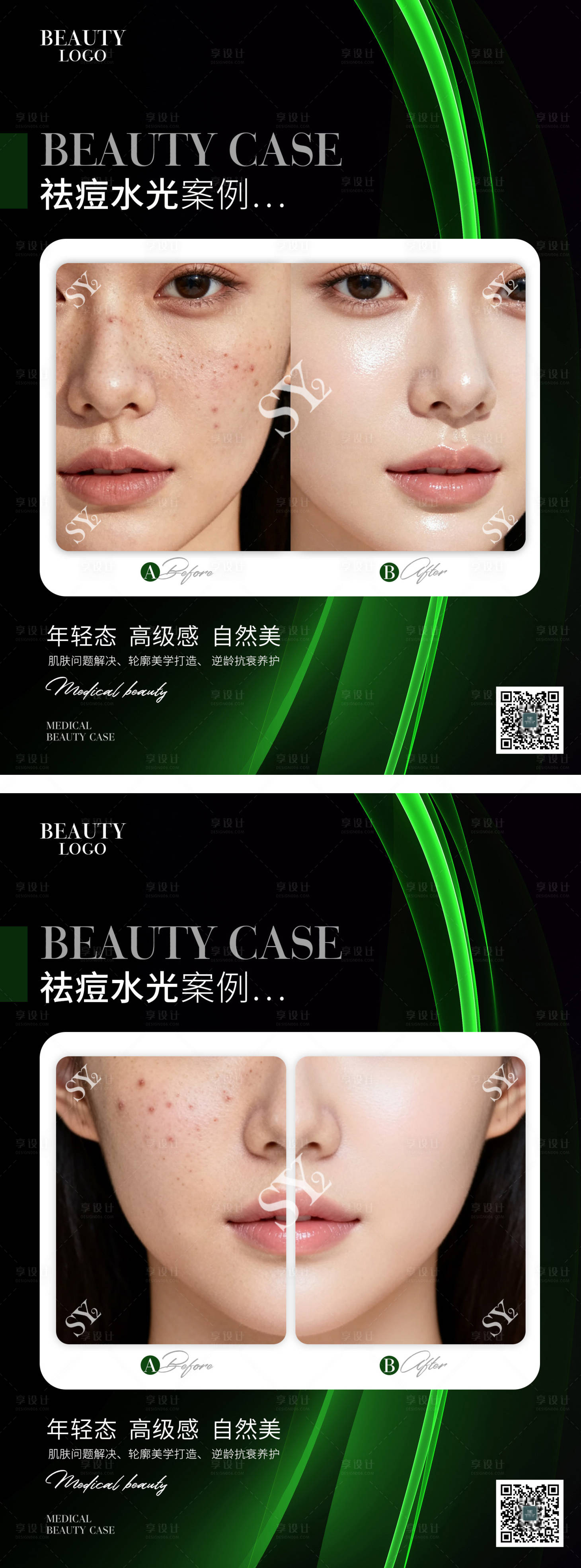 源文件下载【享设计】搜索编号：35830033369825347【对比图标准格式 】