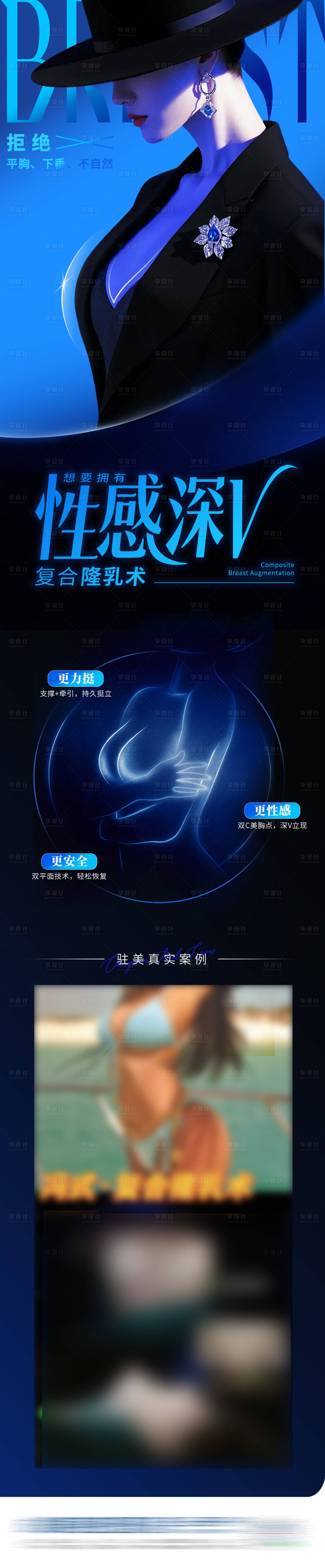 源文件下载【享设计】搜索编号：40600033513523696【医美美胸隆乳隆胸术案例创意长图海报】