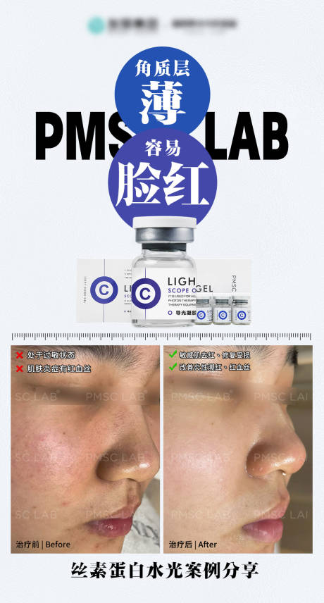 源文件下载【享设计】搜索编号：97030033749628851【敏感肌案例】