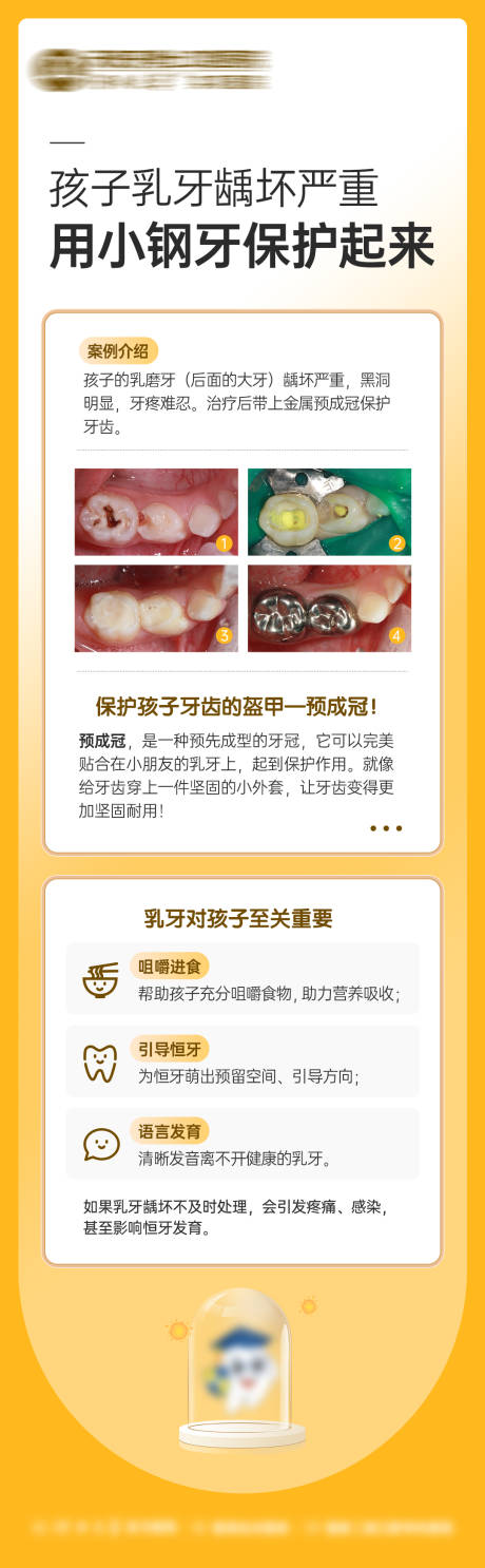 源文件下载【享设计】搜索编号：22200033479332794【乳牙龋坏案例对比海报】