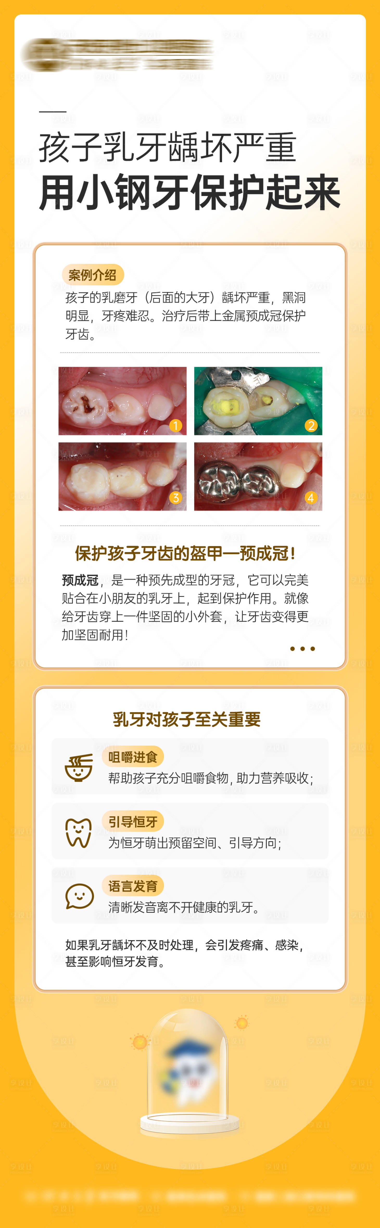 源文件下载【享设计】搜索编号：22200033479332794【乳牙龋坏案例对比海报】