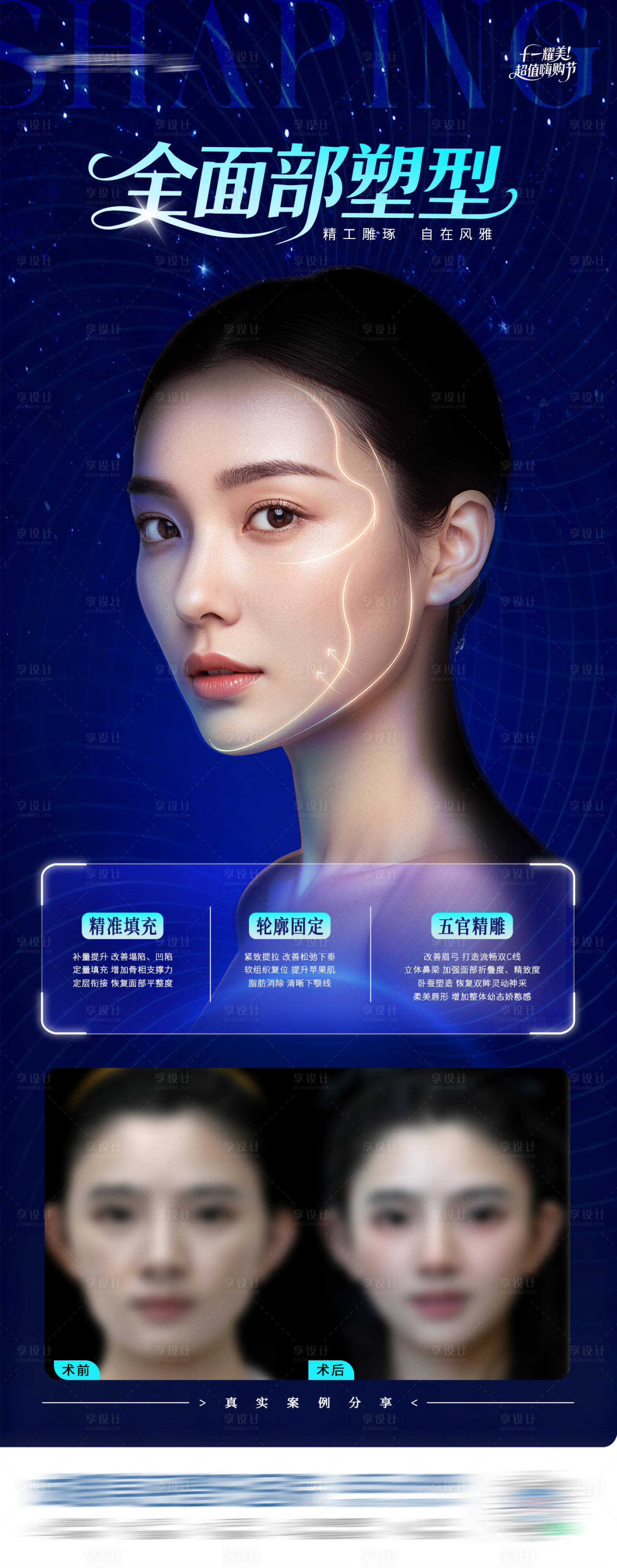 源文件下载【享设计】搜索编号：23170033372022382【医美全面部塑形案例创意长图海报】