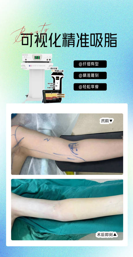 源文件下载【享设计】搜索编号：33850033366358492【精准吸脂】