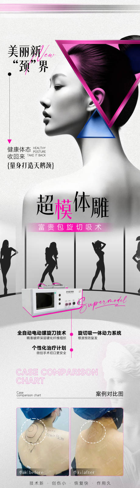 源文件下载【享设计】搜索编号：92510033716932222【超模体雕肩颈富贵包】