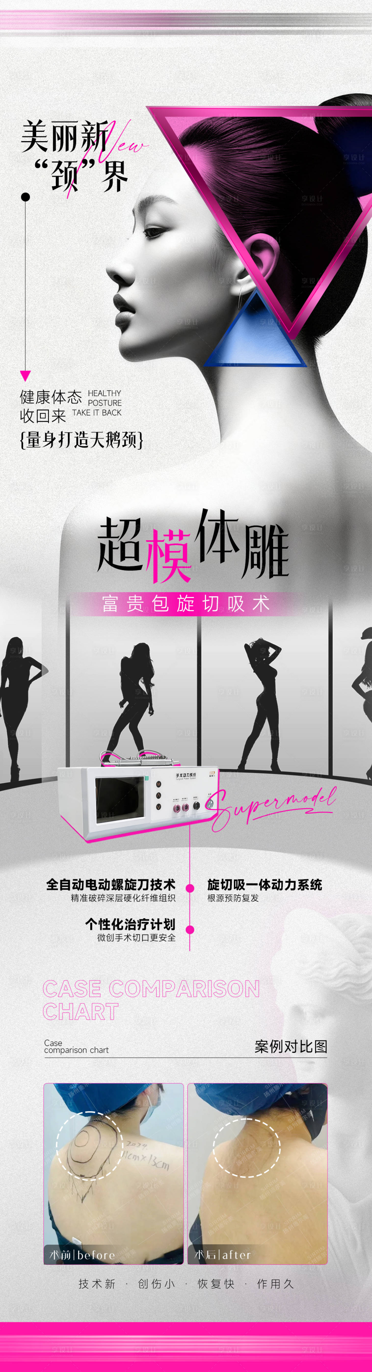 源文件下载【享设计】搜索编号：92510033716932222【超模体雕肩颈富贵包】