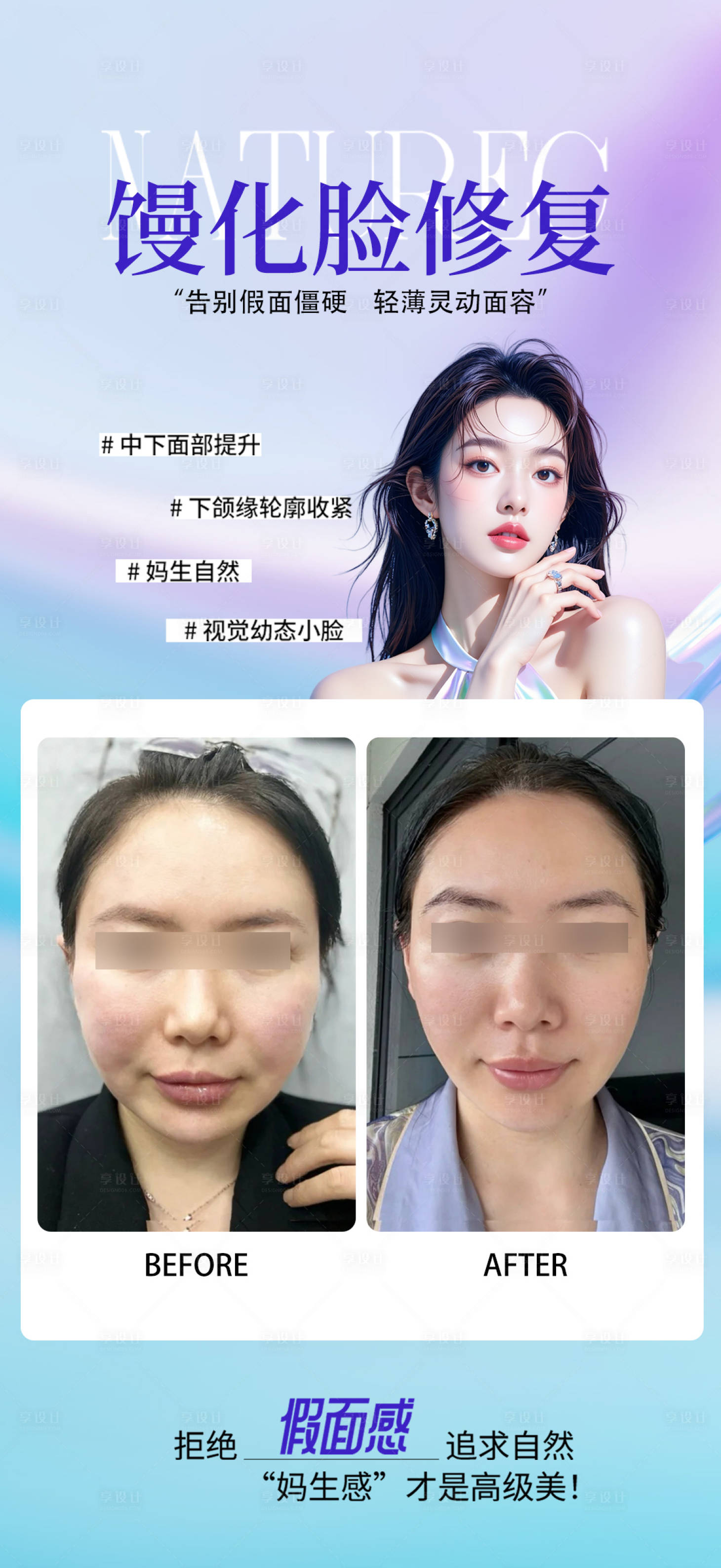 源文件下载【享设计】搜索编号：10760033370289056【馒化脸修复案例】