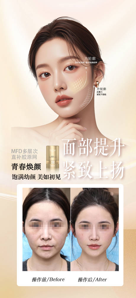 源文件下载【享设计】搜索编号：58800033709924653【医美胶原面部提升案例海报】