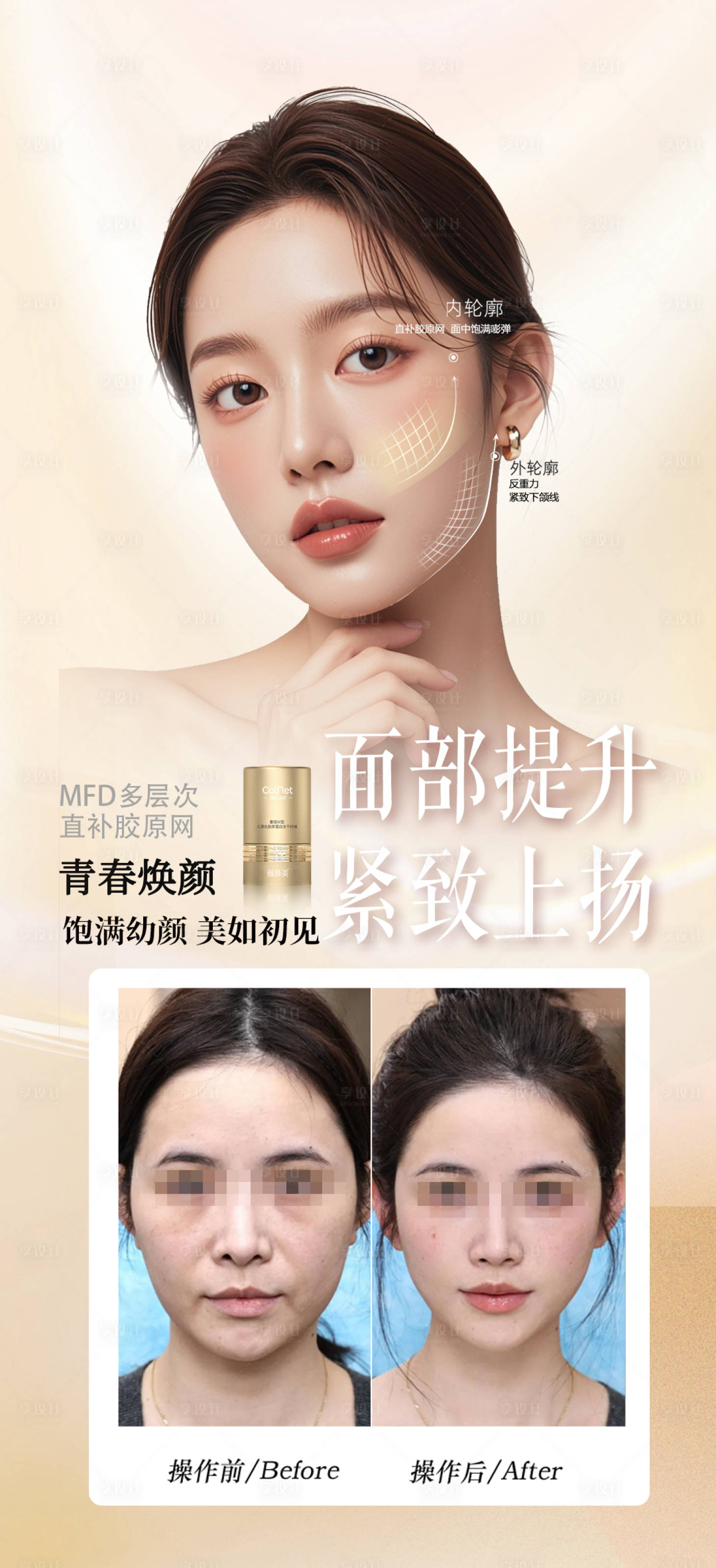 源文件下载【享设计】搜索编号：58800033709924653【医美胶原面部提升案例海报】