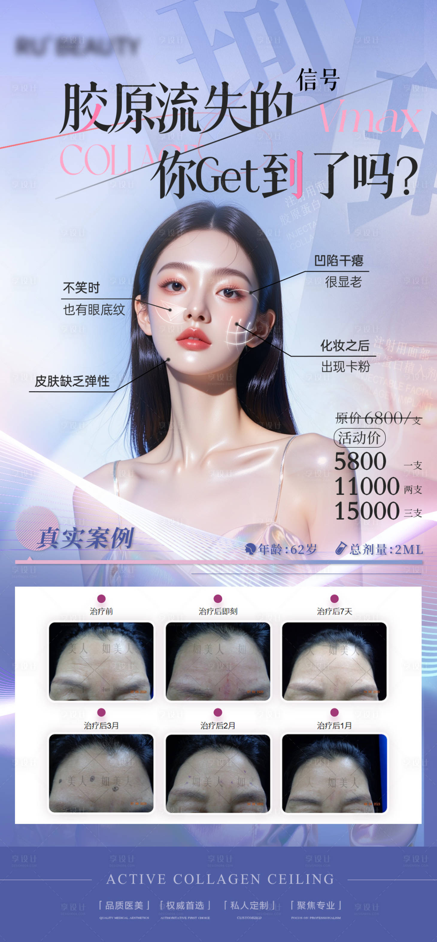 源文件下载【享设计】搜索编号：13820033563025726【医美胶原蛋白植入剂海报】