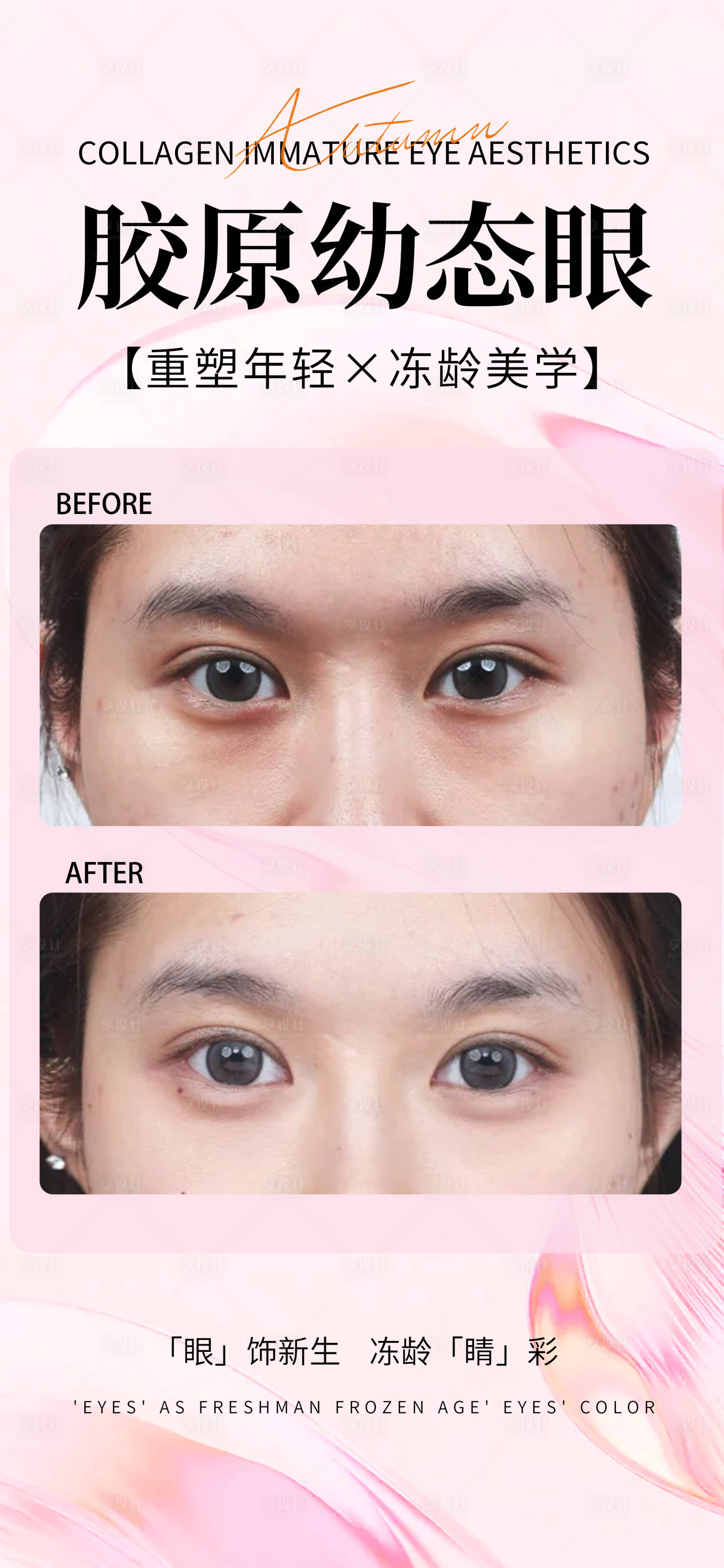 源文件下载【享设计】搜索编号：47010033465073530【胶原眼】