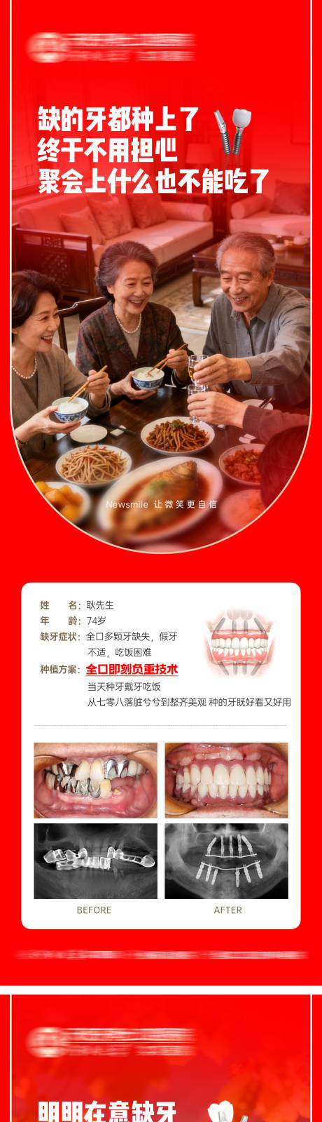 源文件下载【享设计】搜索编号：73020033478559396【种植牙氛围感照片场景海报】